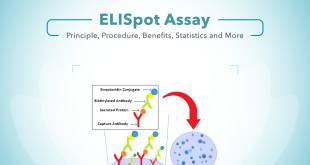 ELISpot Assay | Principle, Procedure, Benefits, and More